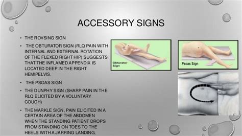 heel drop test appendicitis|rovsing's sign sensitivity and specificity.